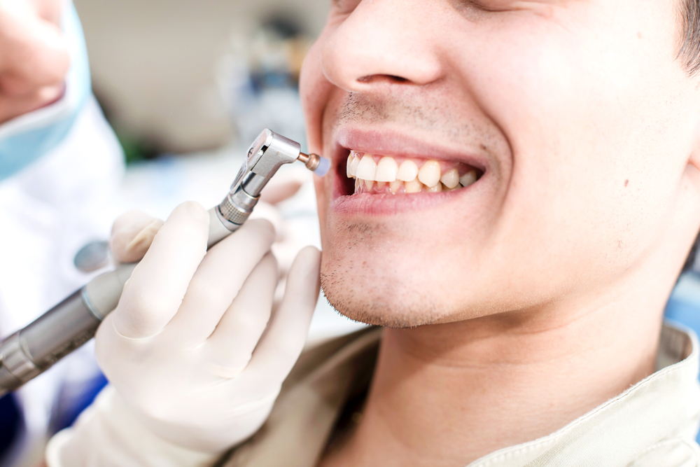 kaip išlaikyti dantis baltais